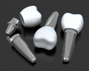 dental implant recovery