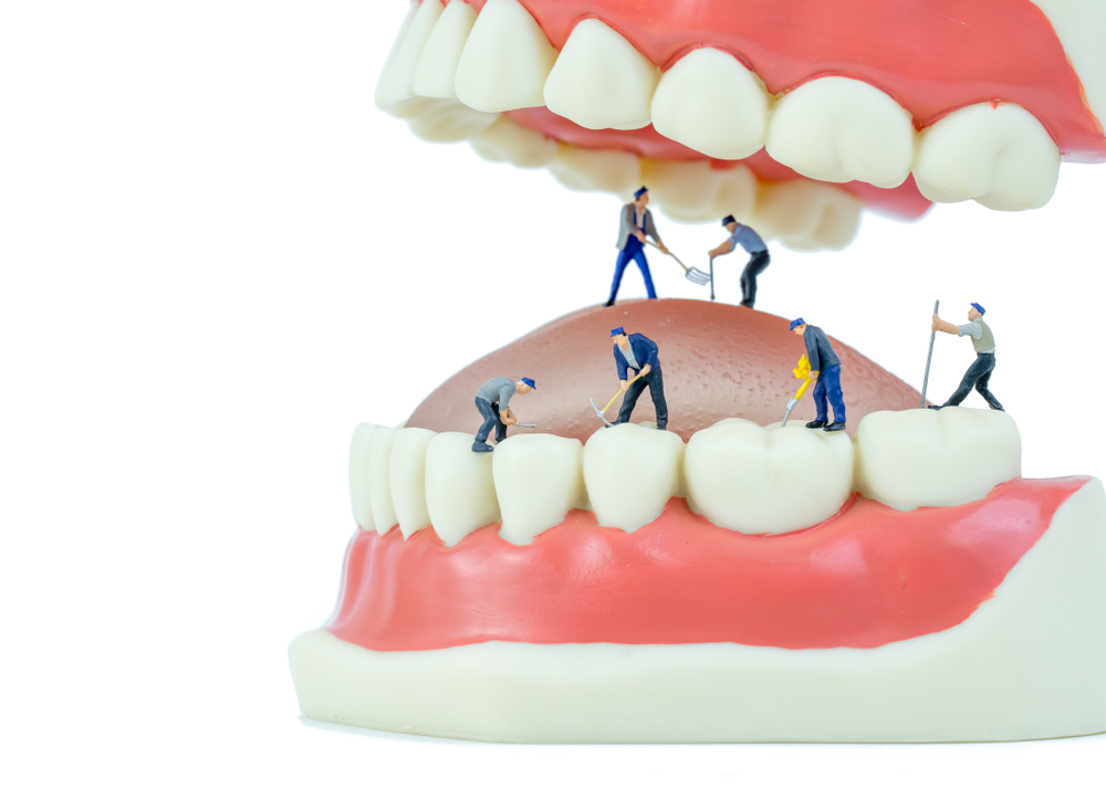 Where Do Dental Implants Come From?