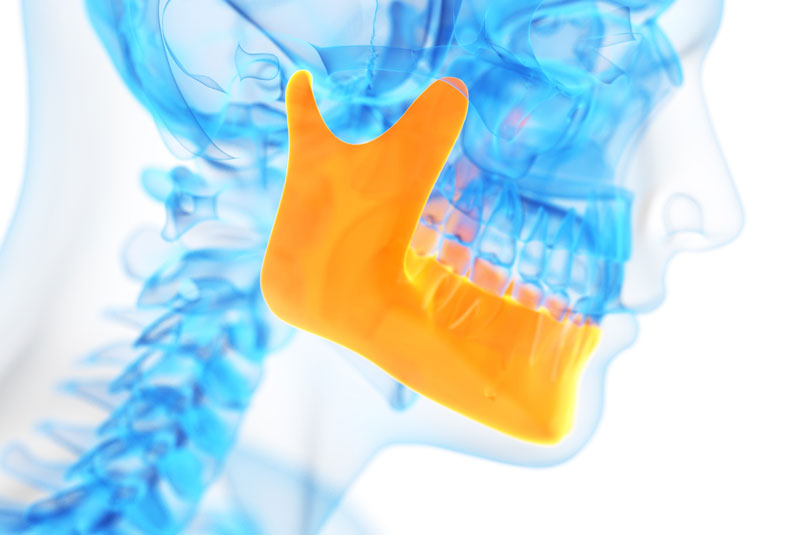 a dental xray showing a jawbone ready for a bone graft.