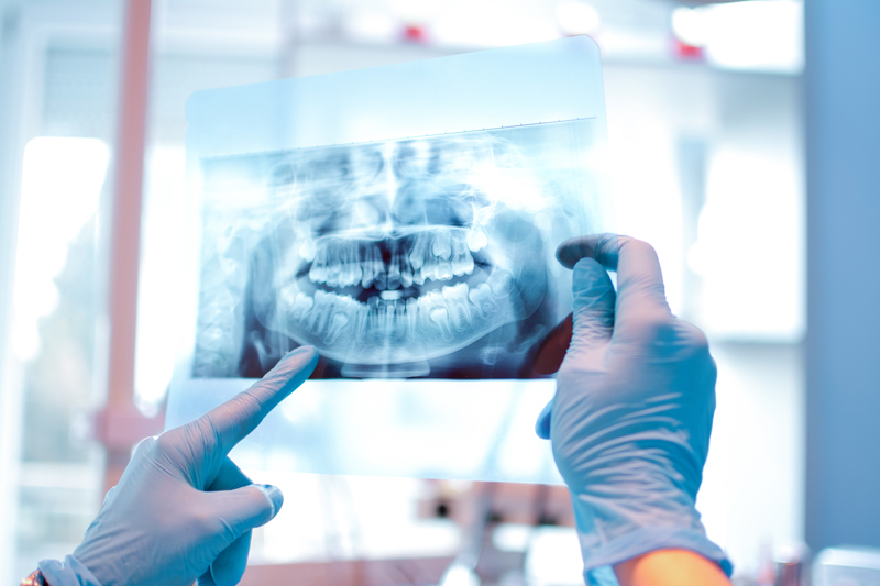 Close-up of a female doctor pointing at teeth x-ray image at dental office.