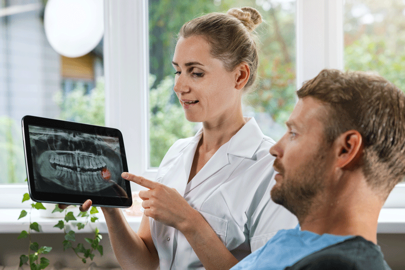 Wisdom tooth x-ray view shown to a dental patient by a dentist.