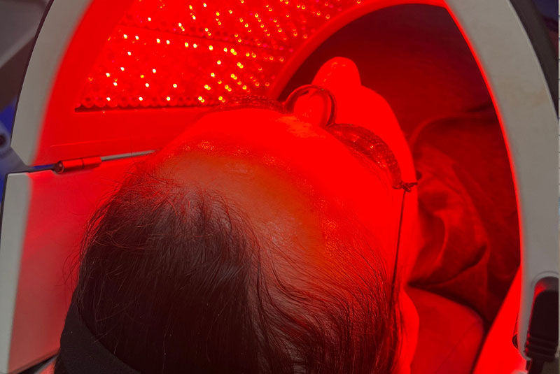 patient undergoing hydrafacial treatment