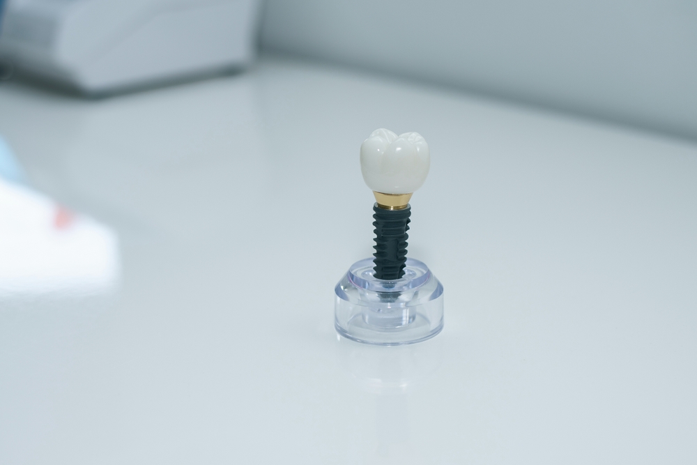 Dentist consulting with a patient about dental implant options in a modern clinic