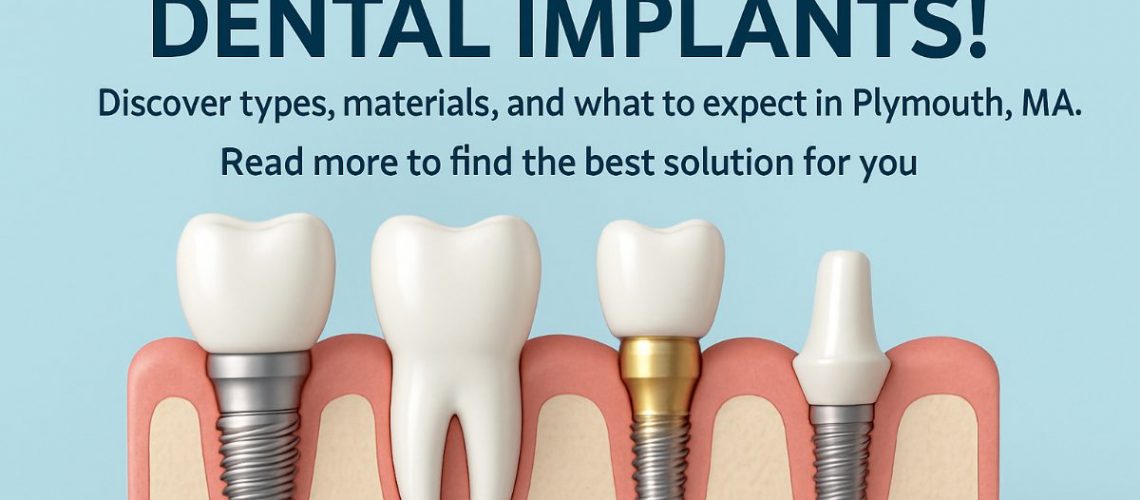 Close-up image of dental implant components, including the implant fixture, abutment, and crown, clearly labeled with corresponding dental implant names, set against a clean, modern background. No text on the image.