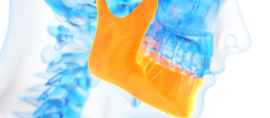 a dental xray showing a jawbone ready for a bone graft.